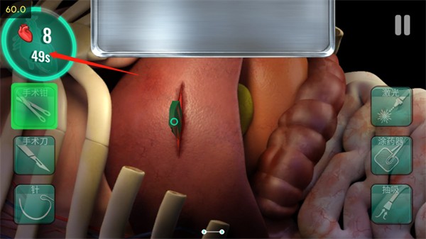 医院手术时间汉化版 app下载